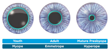 ACUVUE OASYS
