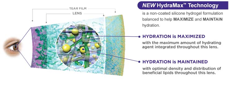acuvue vita lens